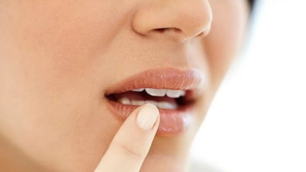 Tujuh Cara Menjaga Kelembapan Bibir yang Benar