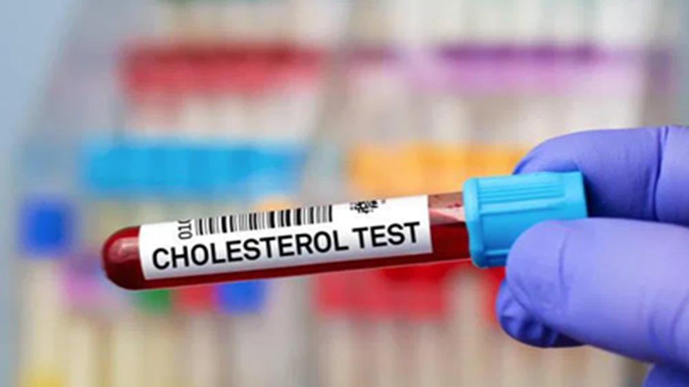 Kolesterol Tinggi pada Orang Kurus: Dokter Spesialis Jantung Ungkap 4 Penyebab Utamanya