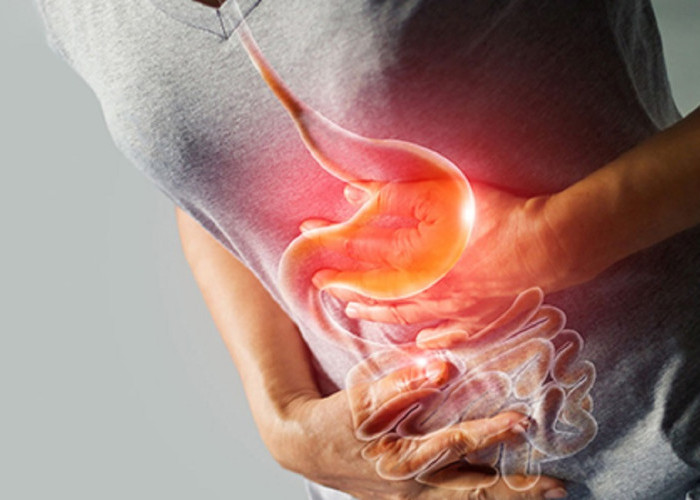 Panduan Kesehatan: Langkah Efektif Mengatasi Maag dan Mencegahnya Kambuh Kembali