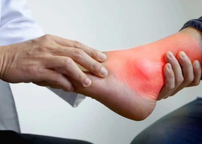 Asam Urat: Kenali Penyebab, Gejala, dan Cara Ampuh Mengatasinya