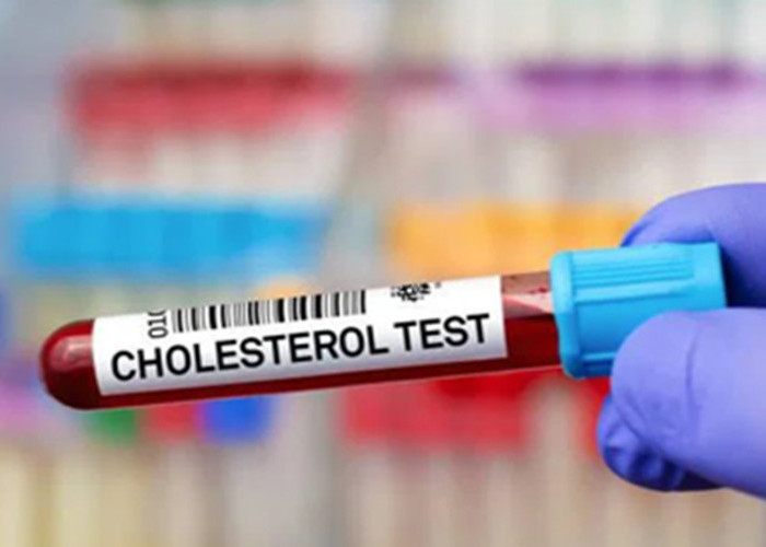 Kolesterol Tinggi pada Orang Kurus: Dokter Spesialis Jantung Ungkap 4 Penyebab Utamanya