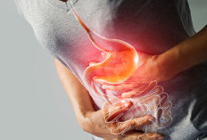 Panduan Kesehatan: Langkah Efektif Mengatasi Maag dan Mencegahnya Kambuh Kembali